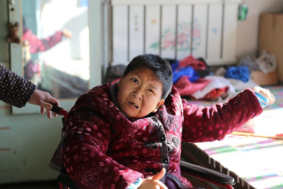 脑瘫患者翘起大拇指赞扬爱先行对她的帮助