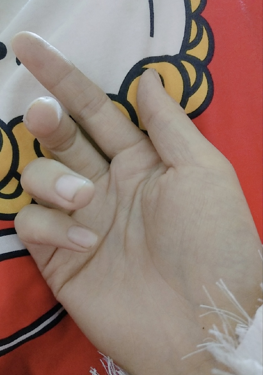 人的手只有那么大握不住的东西太多何况只有一只手的我