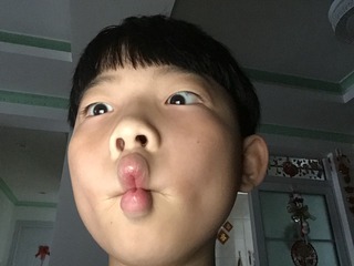 001