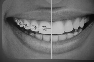 2158877