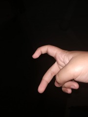 662395