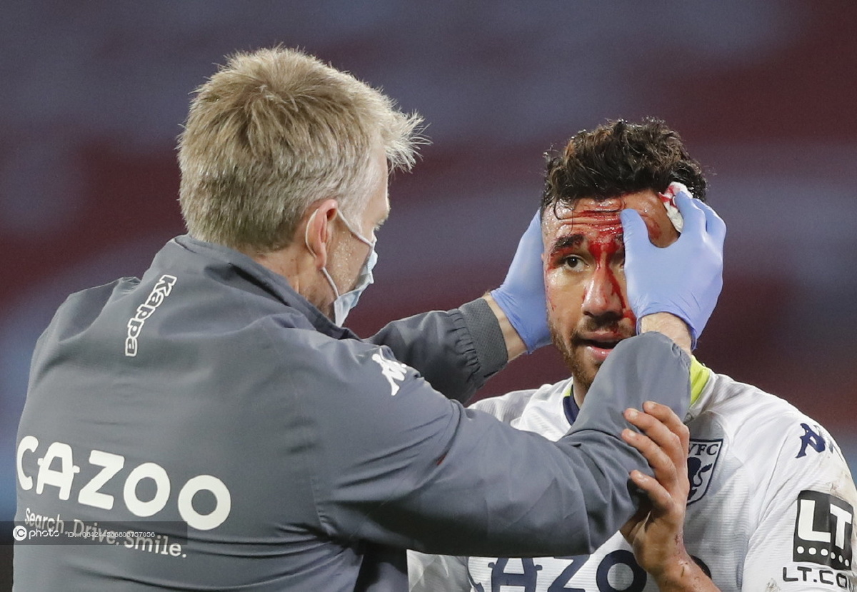 2021赛季英超第10轮西汉姆联vs阿斯顿维拉特雷泽盖头部受伤血流不止