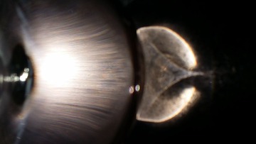 20161217_110039