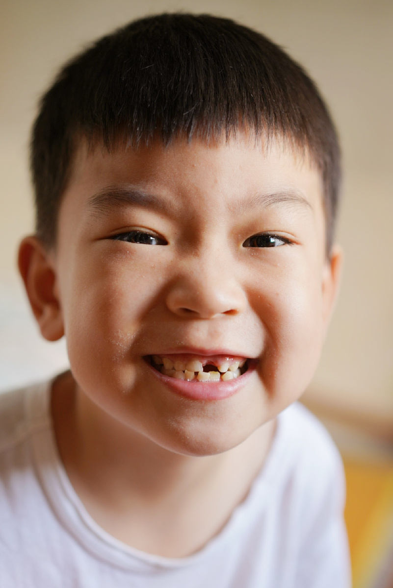 换牙齿的小男孩