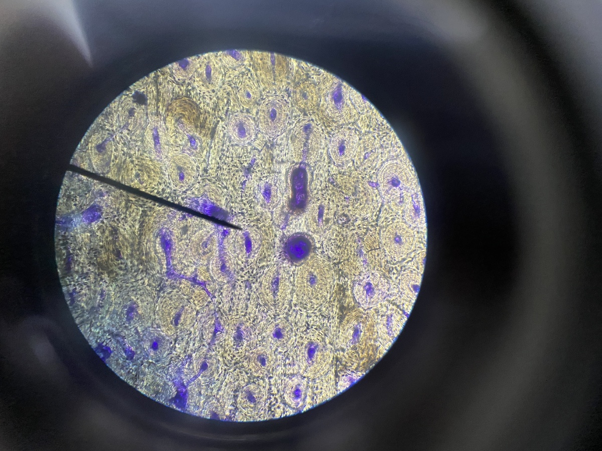 连我的肺细胞都是爱你的形状