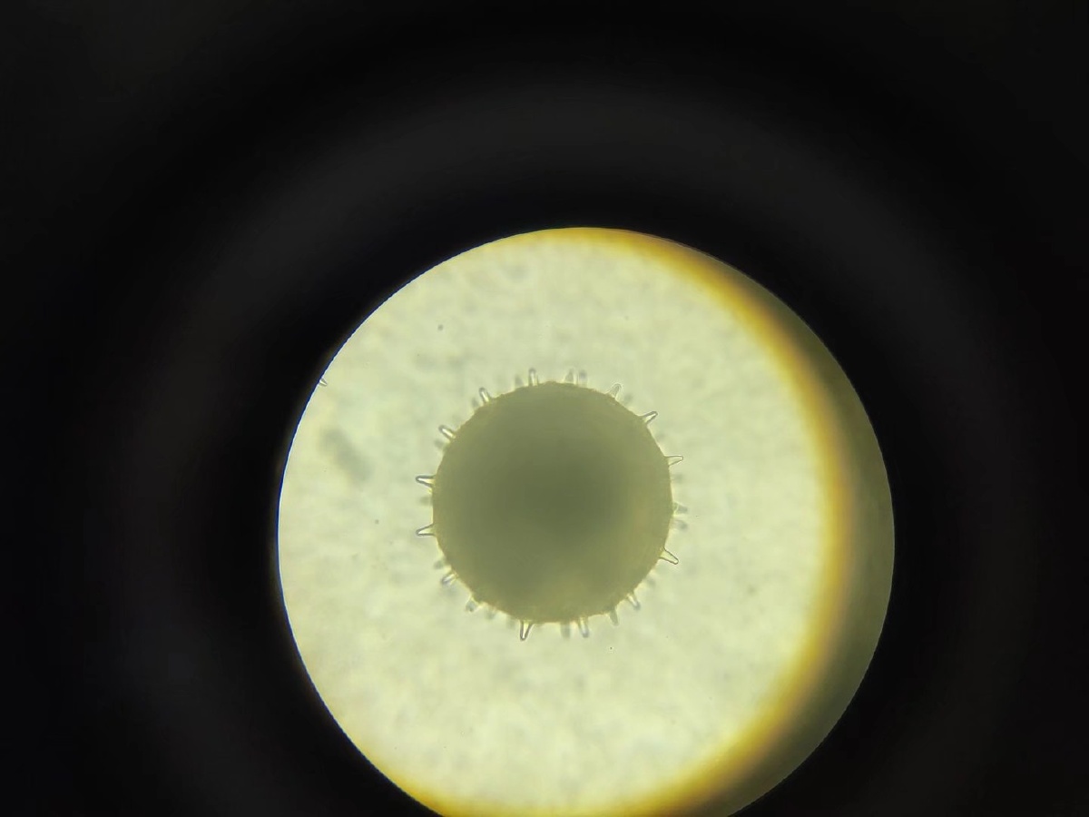 显微镜下特别的花粉