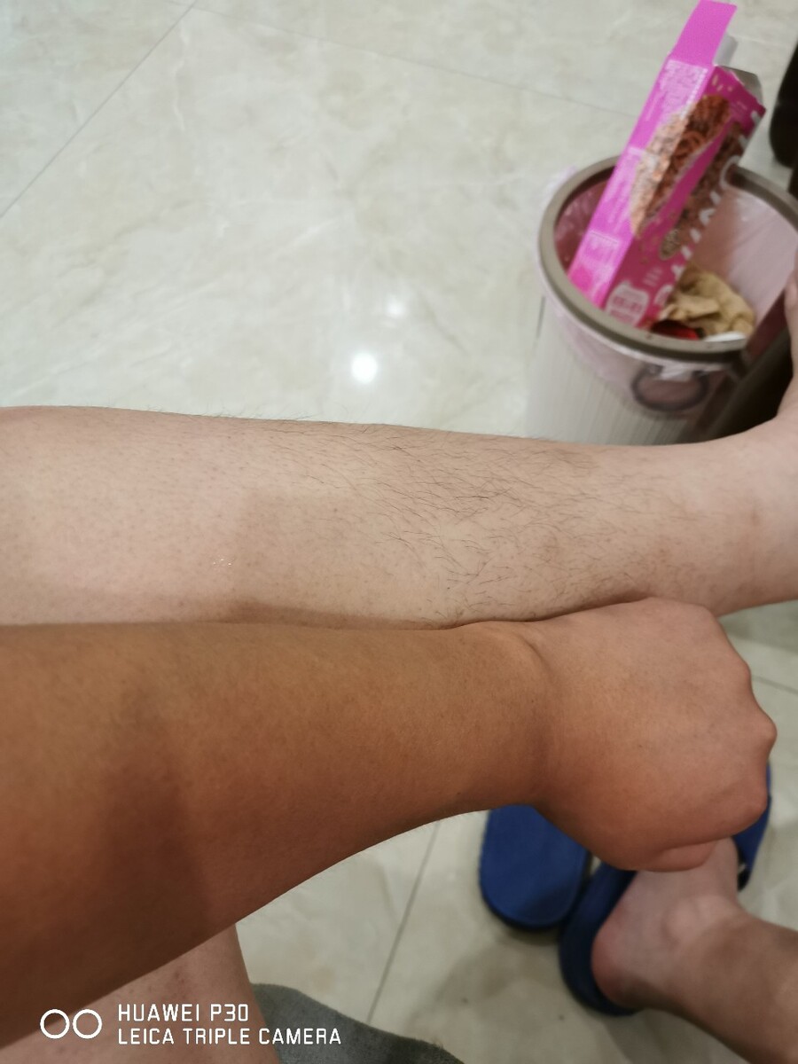 人失水什么症状