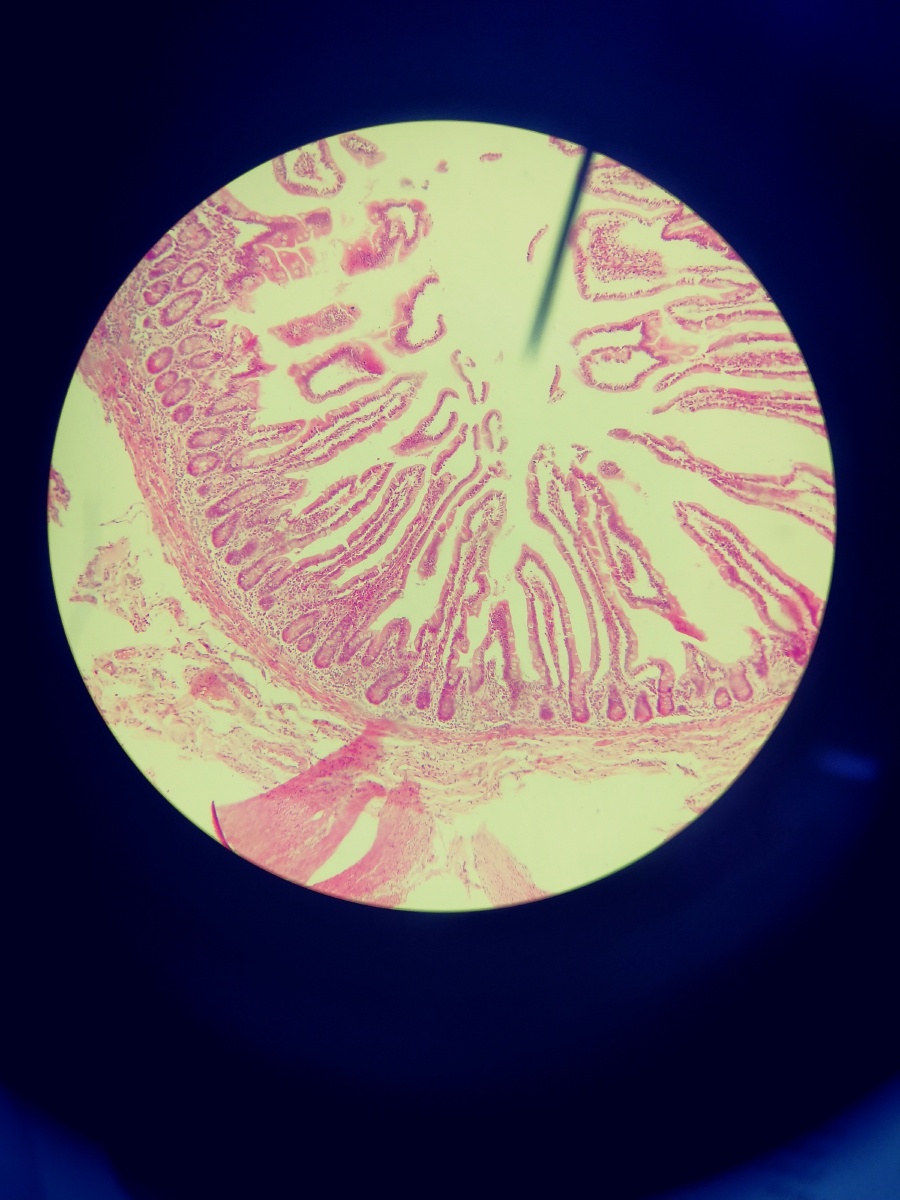 肠×100,胃×400 胃小凹(胃),皱襞,绒毛,纹状缘(肠)三级结构扩大了