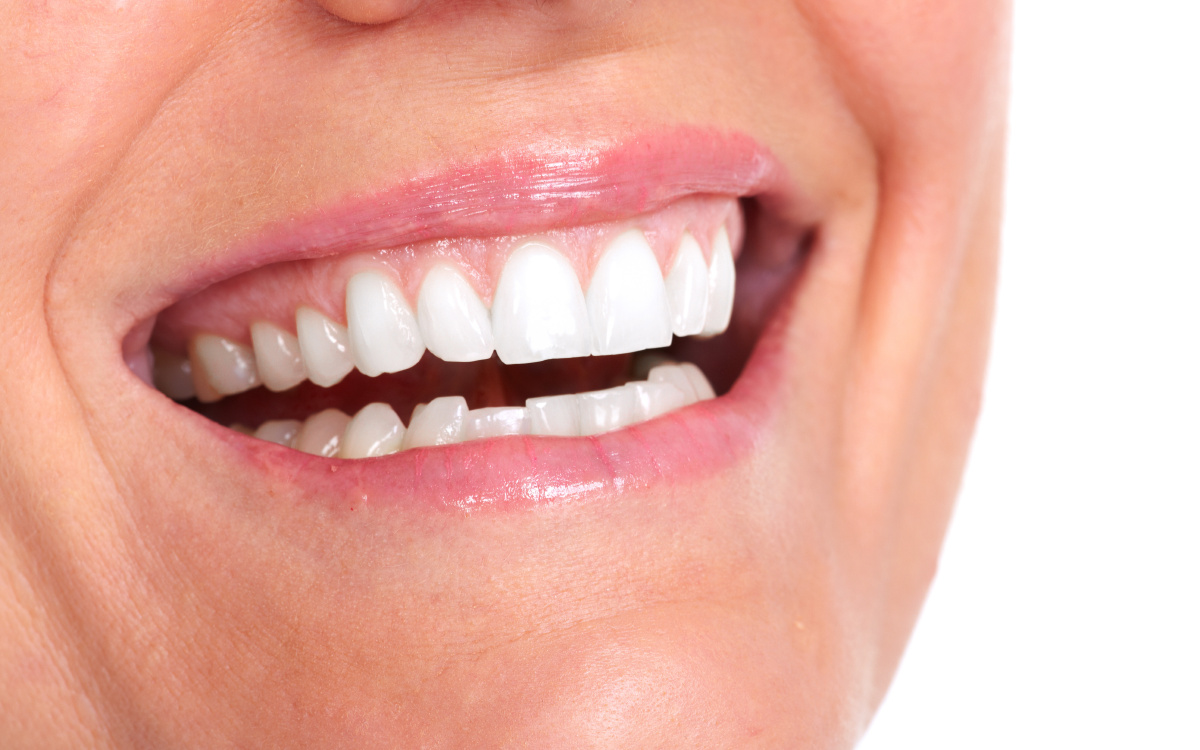 洁白牙齿牙齿医生黄皮肤白皮肤口腔医学