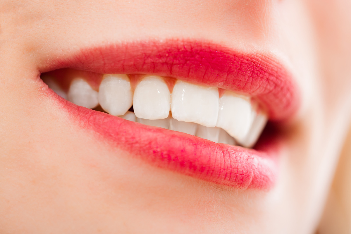 洁白牙齿牙齿医生黄皮肤白皮肤口腔医学