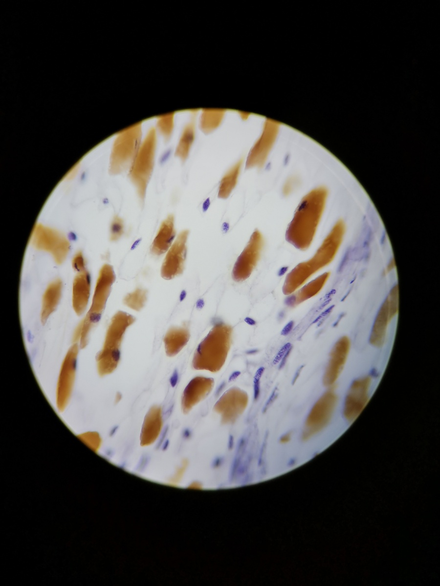 松雄球果切片 - 摄影师161664517449181 - 图虫