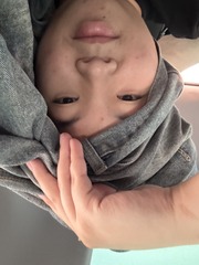 001