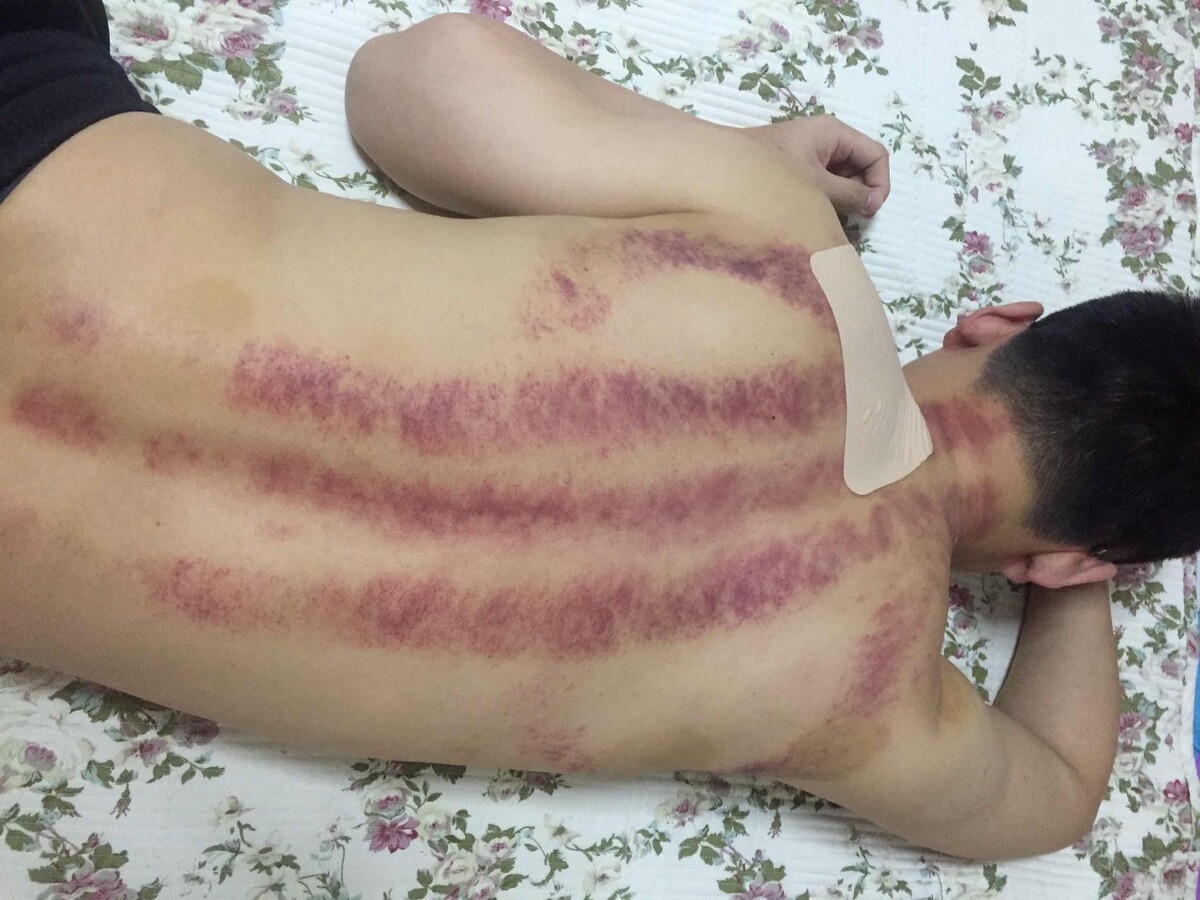 人失水什么症状,人体若中度脱水会产生幻觉甚至危及生命