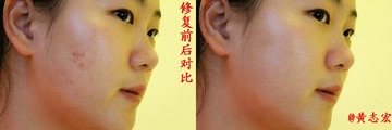 黄志宏【修复前后】