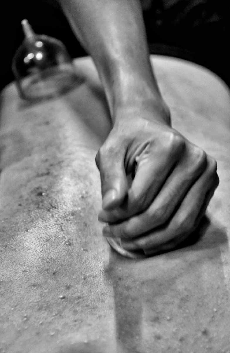 拔火罐的男青年