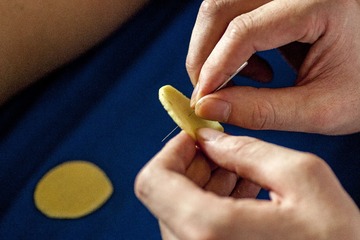 2015年7月11日，河南省滑县县城道口镇何氏中医艾灸馆，人们在做中医隔姜灸，冬病夏治。 (1)