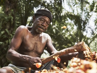 WaterAid-Tombos-Wound-Sierra-Leone-Joey-L-050