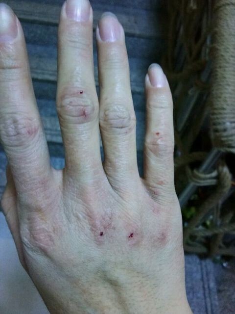 指甲油对人体的危害 爱美的女性也慎用指甲油