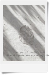scars.JPG
