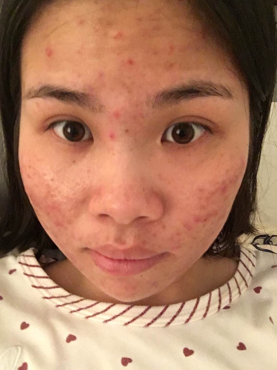 脸部皮肤不光滑,如何保持好的肌肤?