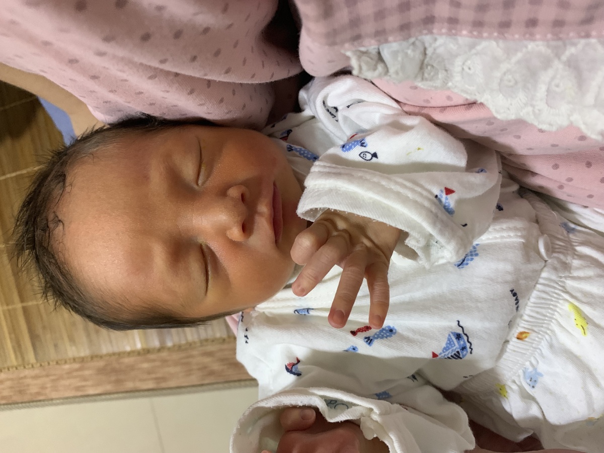 两次唇腭裂需要检查