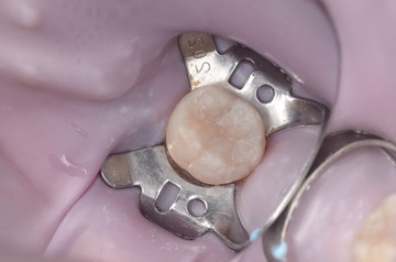 2708443