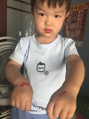 001